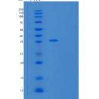 人转录延伸因子A1(TCEA1)重组蛋白