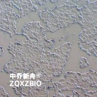 RMG-I人卵巢癌细胞