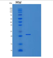 人TATA框结合蛋白关联因子9(TAF9)重组蛋白
