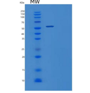 人间质性肾炎抗原样蛋白1(TINAGL1)重组蛋白