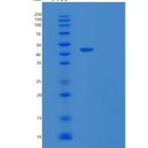 大肠杆菌TARDBP重组蛋白
