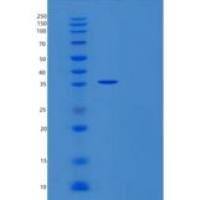 人THAP11重组蛋白