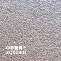 SUM159PT 人乳腺癌细胞