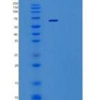 人肿瘤坏死因子受体超家族成员8(TNFRSF8)重组蛋白