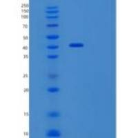 人转化生长因子β受体Ⅱ(TGFbR2)重组蛋白
