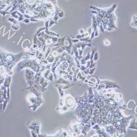 LS1034/LS1034细胞/LS-1034细胞/LS-1034/人结肠腺癌细胞/STR鉴定/镜像绮点(Cellverse)