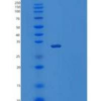 人可溶性胸苷激酶1(TK1)重组蛋白