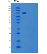 人转酮醇酶(TKT)重组蛋白