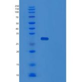 人Toll样受体衔接分子2(TICAM2)重组蛋白