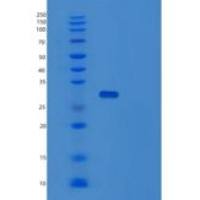 人Toll样受体衔接分子2(TICAM2)重组蛋白