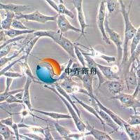 SW1271人小细胞肺癌细胞