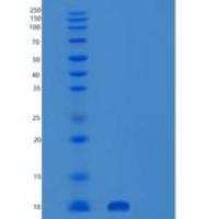人SUMO-1重组蛋白