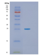 人肿瘤坏死因子α诱导蛋白8(TNFAIP8)重组蛋白