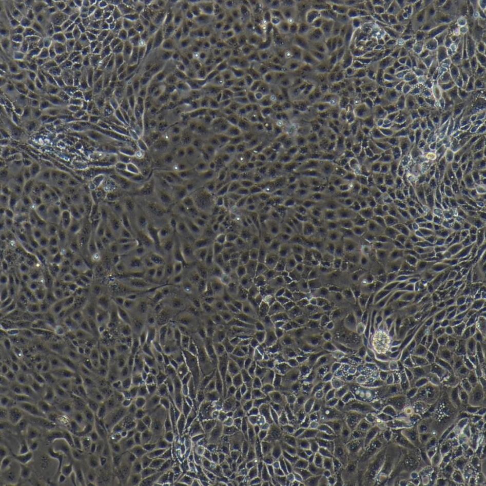 兔脐静脉内皮细胞/免疫荧光鉴定/镜像绮点（Cellverse）