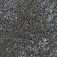 兔脐静脉内皮细胞/免疫荧光鉴定/镜像绮点（Cellverse）