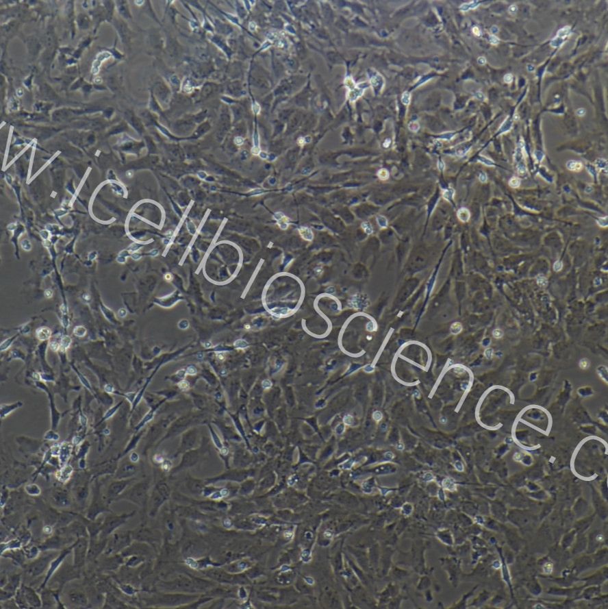 小鼠眼外肌成纤维细胞  免疫荧光鉴定 镜像绮点（Cellverse）