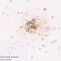 Anti-beta Amyloid 1-40[EPR23712-2]