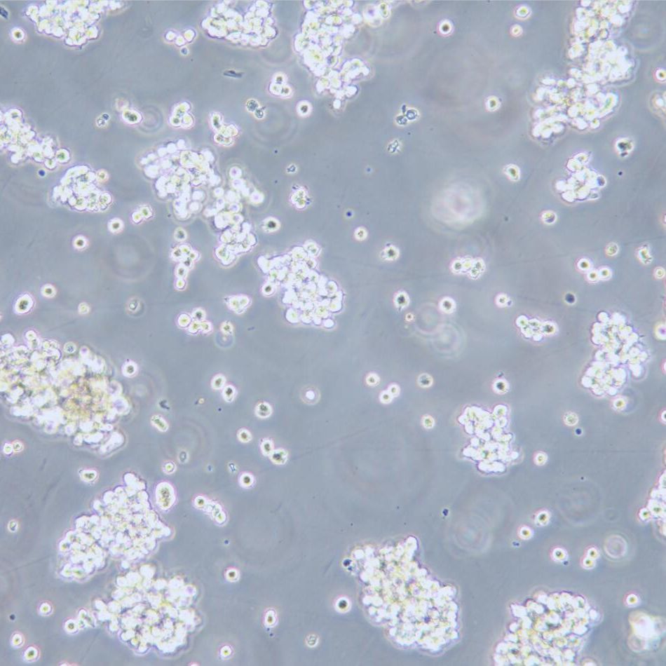 Hut-78 人T淋巴细胞白血病细胞 STR鉴定 镜像绮点（Cellverse）