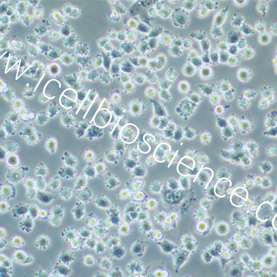 IHH4 人甲状腺乳头状癌细胞  STR鉴定 镜像绮点（Cellverse）