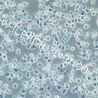 IHH4 | IHH4细胞 | 人甲状腺乳头状癌细胞 | STR鉴定 | 镜像绮点