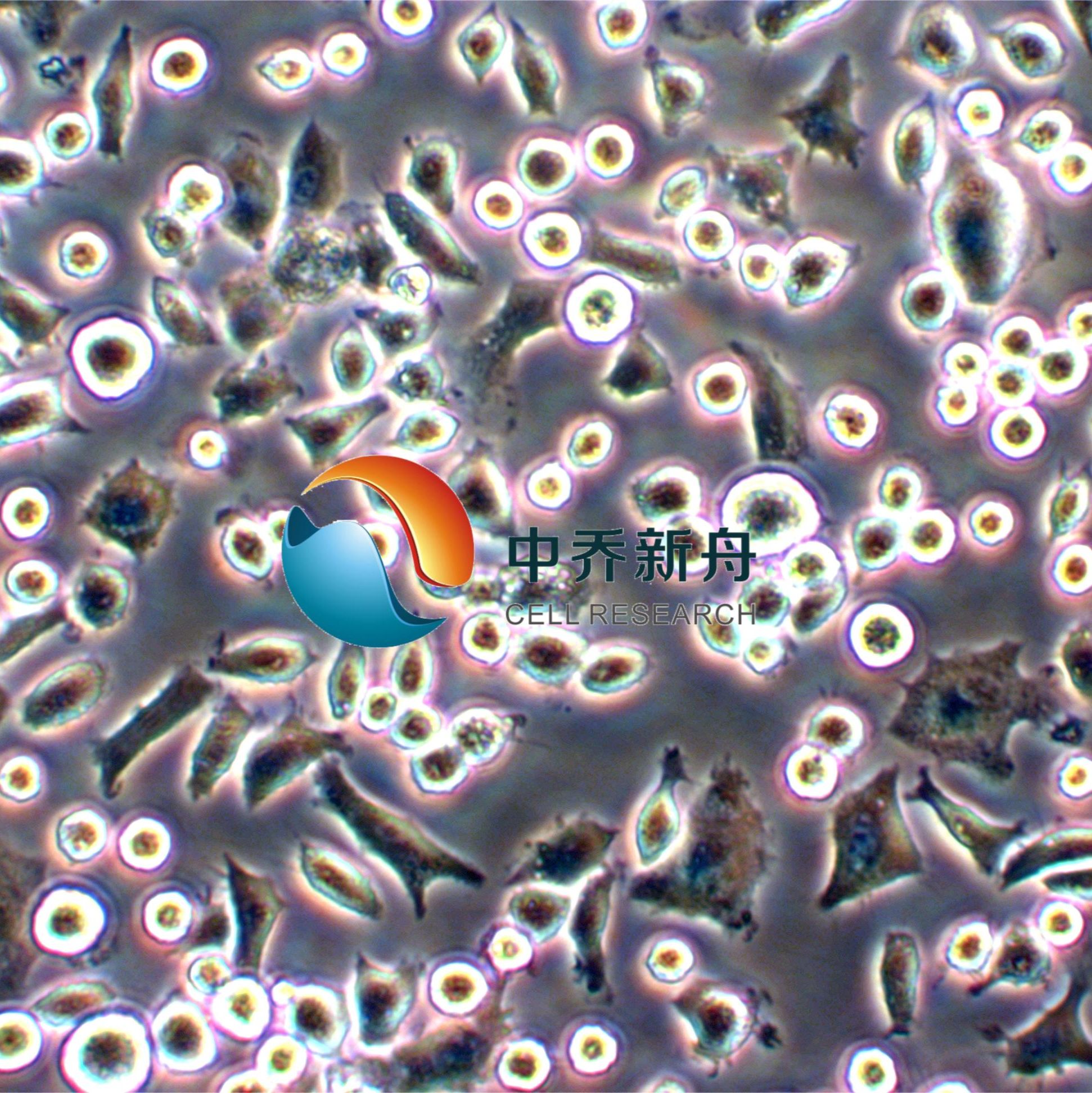 JAWSII小鼠骨髓 (未成熟)树突状细胞