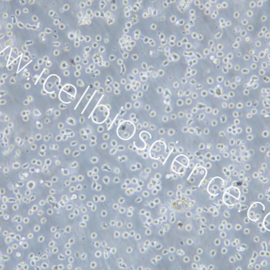 Karpas299 人间变性大细胞淋巴瘤细胞/镜像绮点（Cellverse）