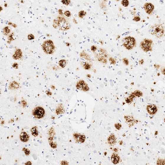 Anti-Amyloid Fibril[mOC78] - Conformation-Specific