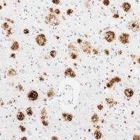 Anti-Amyloid Fibril[mOC78] - Conformation-Specific