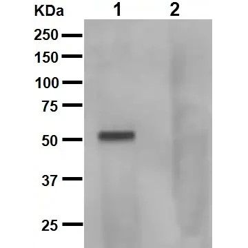 Anti-Tau (phospho S262 + T263)