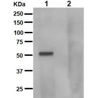 Anti-Tau (phospho S262 + T263)