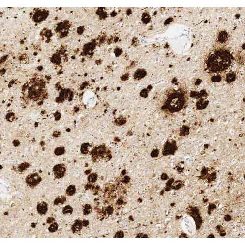 Anti-Amyloid Fibril[mOC22] - Conformation-Specific