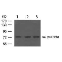 Anti-Tau (phospho S416)