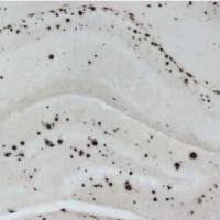 Anti-beta Amyloid 1-42[mOC64]