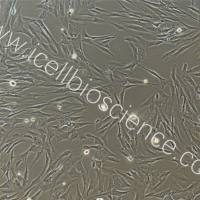 人前庭鞘膜瘤细胞永生化/免疫荧光鉴定/镜像绮点（Cellverse）