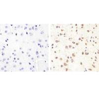 Anti-Tau (phospho S409)