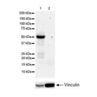 Anti-Tau (MBD region)