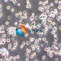 IM9人外周血B淋巴瘤细胞