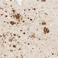 Anti-beta Amyloid 1-42))