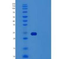 人肿瘤坏死因子受体超家族成员1B重组蛋白