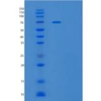 人泛醌蛋白2(UBQLN2)重组蛋白