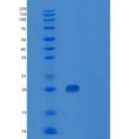 人CD147 / EMMPRIN /碱性蛋白重组蛋白