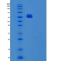 人尿苷单磷酸合成酶(UMPS)重组蛋白