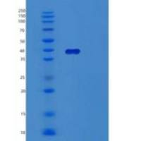 人TPST2重组蛋白