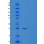 大肠杆菌TPX重组蛋白