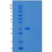 人UBE2H重组蛋白