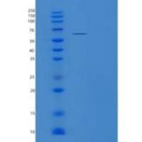 人TUBG1重组蛋白