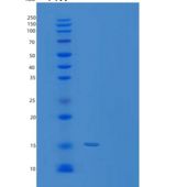 人TXNDC17重组蛋白