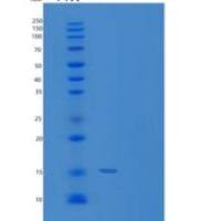 人TXNDC17重组蛋白