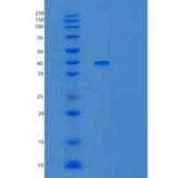人UBLCP1重组蛋白