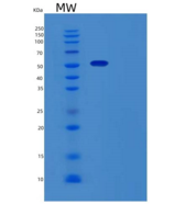人微管蛋白β3(TUBb3)重组蛋白